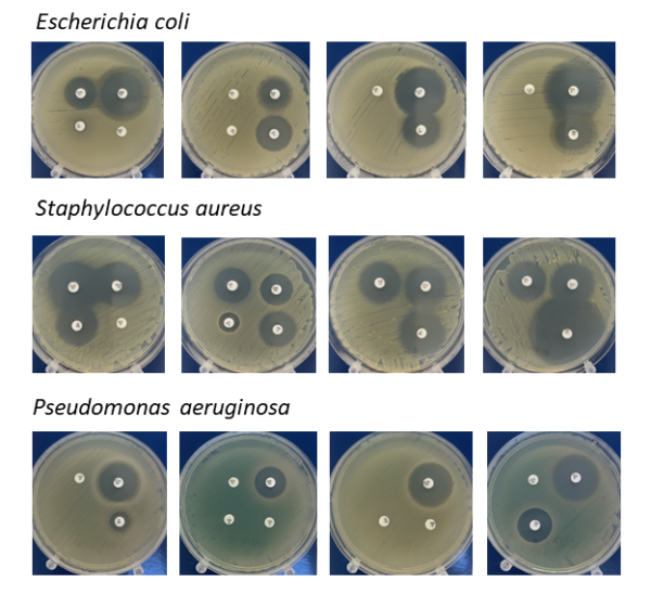 Antibiotic Susceptibility Test